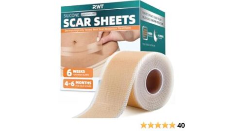 Silicone Scar Sheets